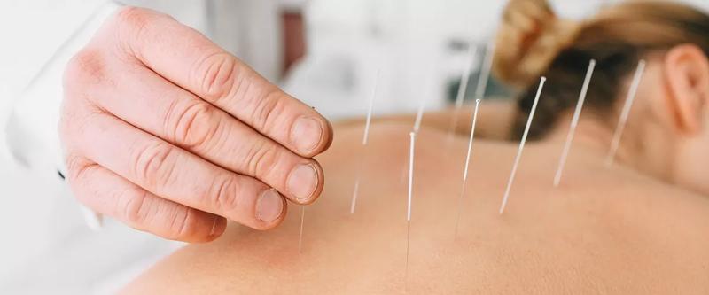 Akupunktura w medycynie
