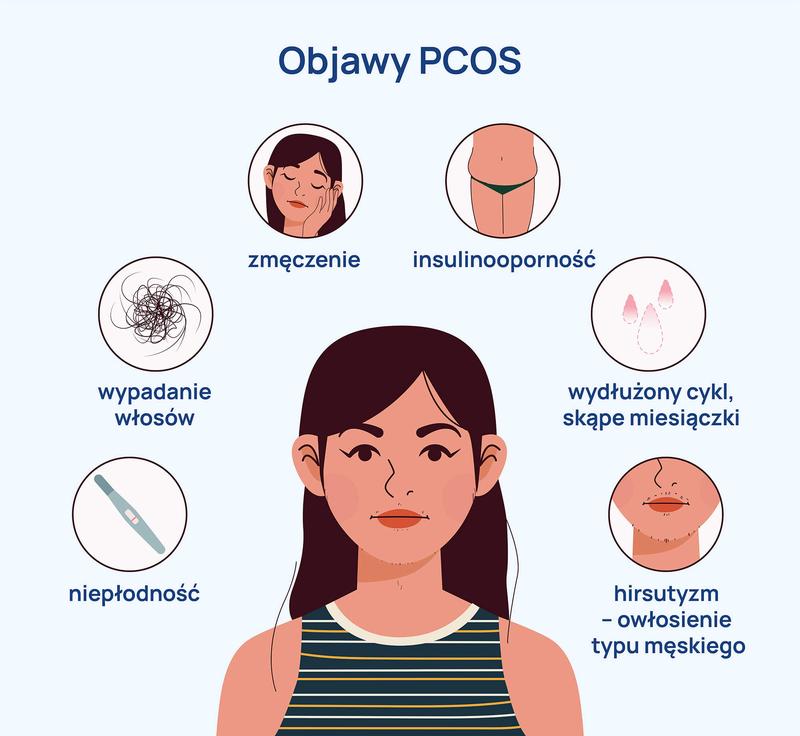 Zespół policystycznych jajników